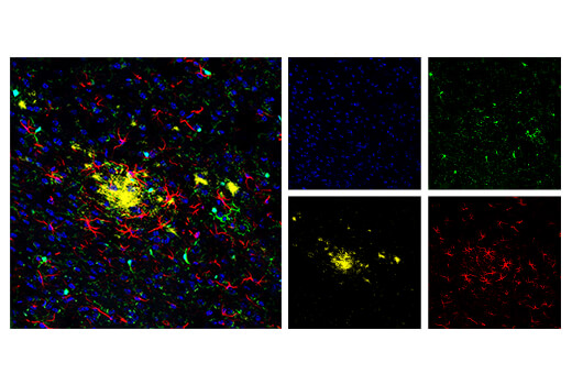 Immunofluorescence Image 1: β-Amyloid (D54D2) XP® Rabbit mAb (Alexa Fluor® 594 Conjugate)