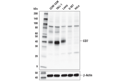 Western Blotting Image 2: CD7 Antibody