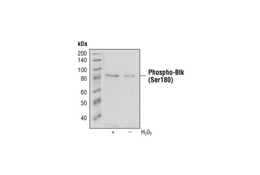 Western Blotting Image 1: Phospho-Btk (Ser180) (3D3) Mouse mAb
