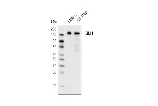  Image 5: Hedgehog Signaling Antibody Sampler Kit