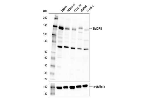 Western Blotting Image 2: SMCR8 Antibody