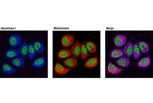 Immunofluorescence Image 1: Hexokinase I (C35C4) Rabbit mAb (Alexa Fluor® 647 Conjugate)