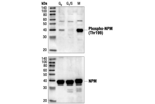 Western Blotting Image 1: Phospho-NPM (Thr199) Antibody