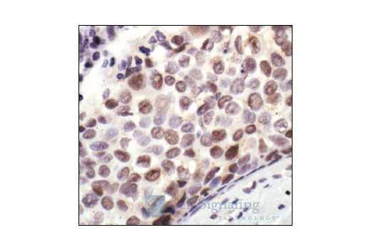 Immunohistochemistry Image 2: Phospho-NPM (Thr199) Antibody