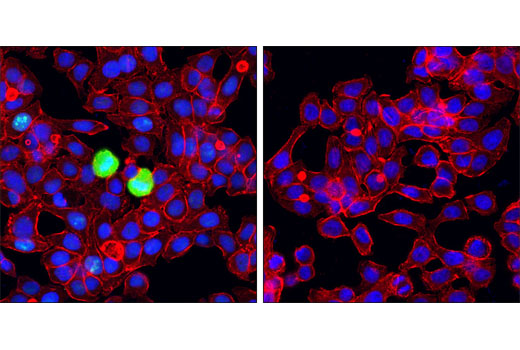 Immunofluorescence Image 1: Phospho-NPM (Thr199) Antibody