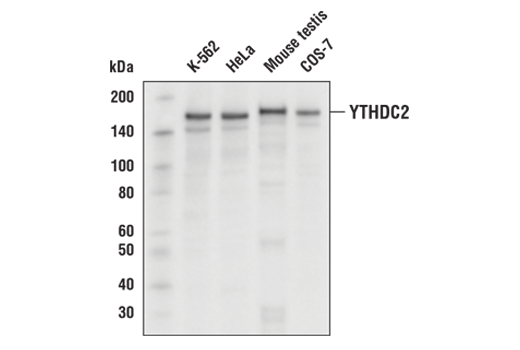 Western Blotting Image 1: YTHDC2 Antibody