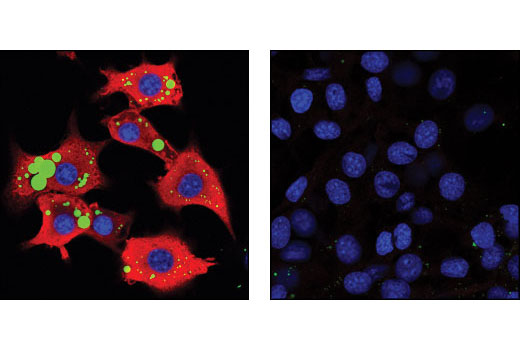 Immunofluorescence Image 1: FABP4 (D25B3) XP® Rabbit mAb