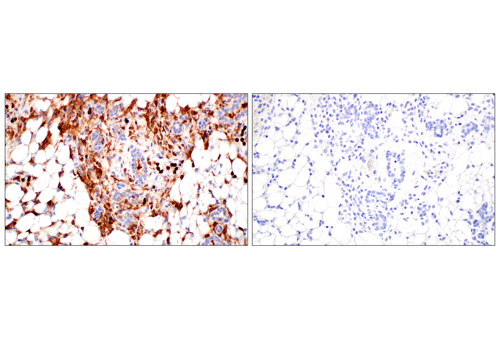 Immunohistochemistry Image 11: CD11b/ITGAM (E4K8C) Rabbit mAb (BSA and Azide Free)