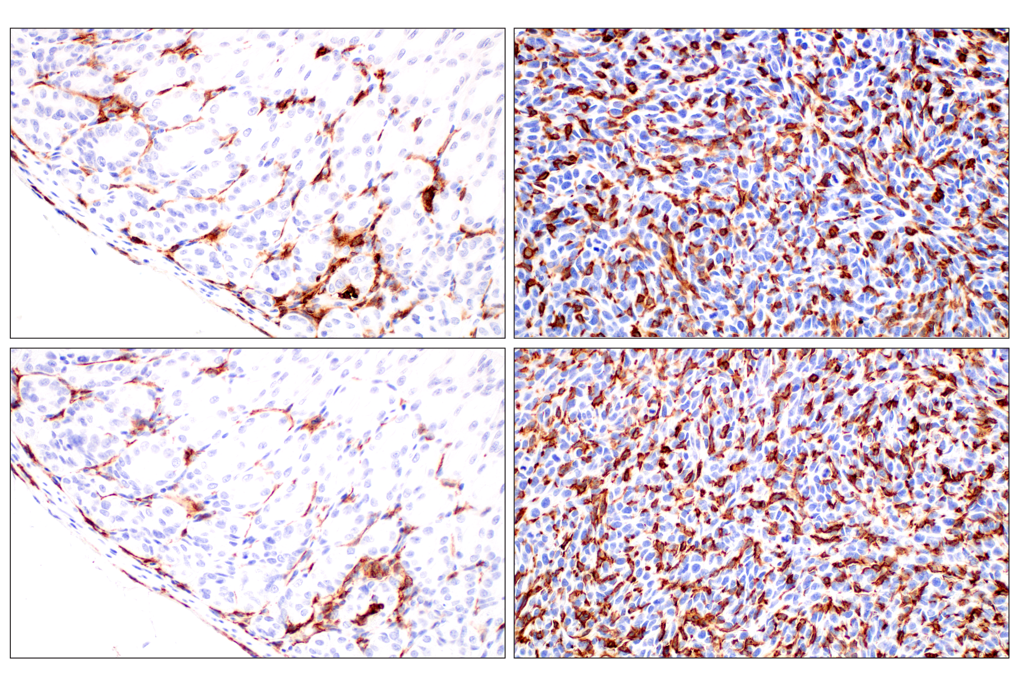 Immunohistochemistry Image 10: CD11b/ITGAM (E4K8C) Rabbit mAb (BSA and Azide Free)