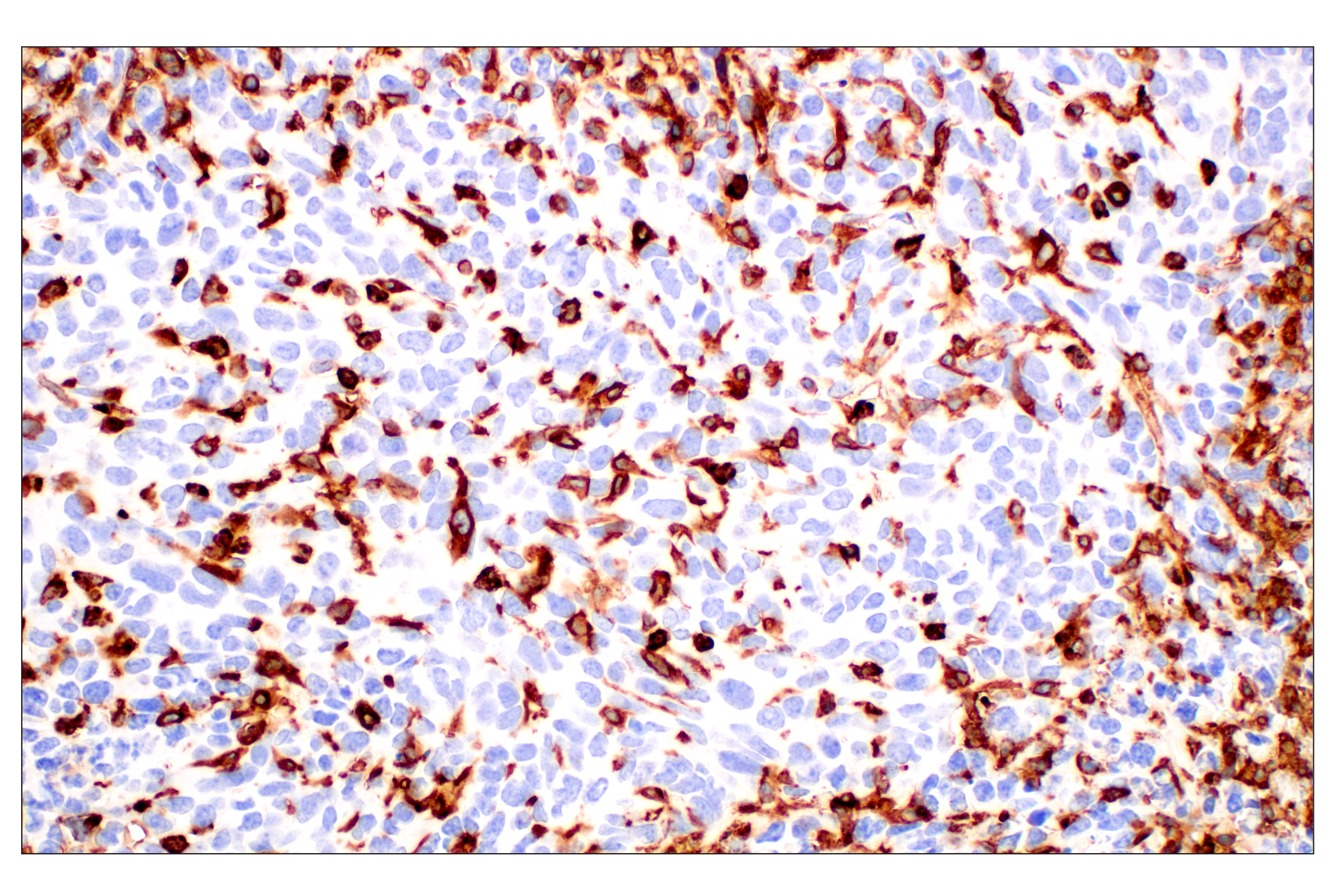 Immunohistochemistry Image 4: CD11b/ITGAM (E4K8C) Rabbit mAb (BSA and Azide Free)