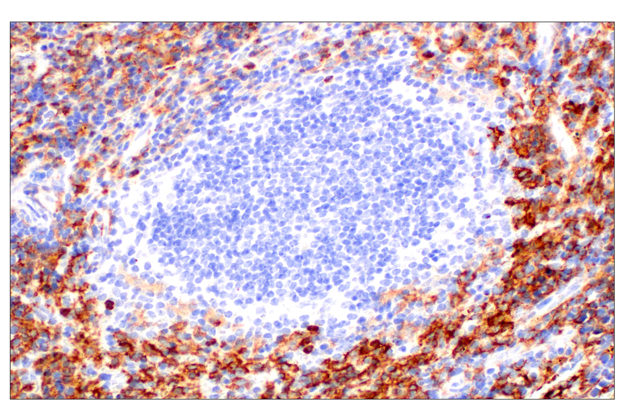 Immunohistochemistry Image 5: CD11b/ITGAM (E4K8C) Rabbit mAb (BSA and Azide Free)