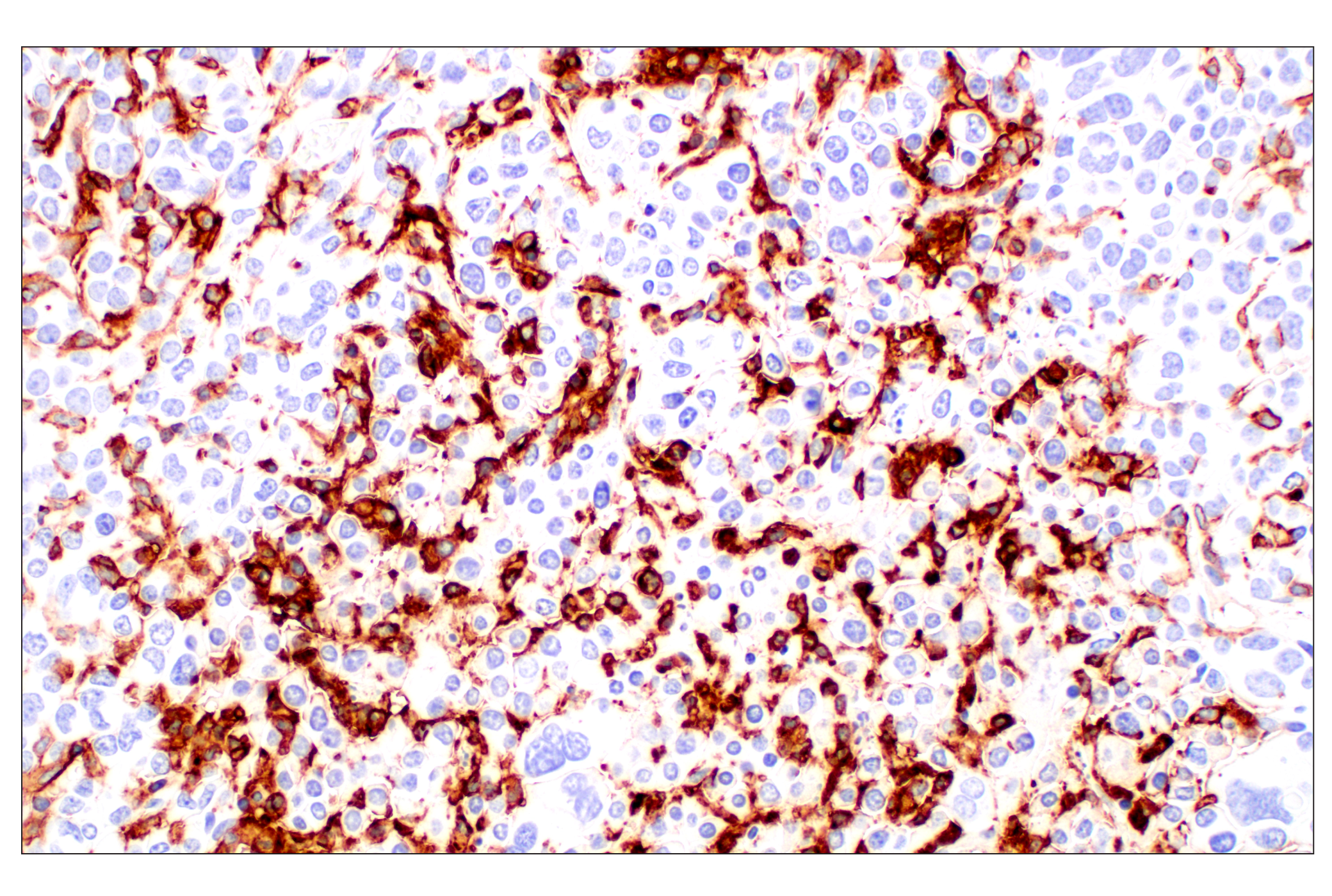 Immunohistochemistry Image 3: CD11b/ITGAM (E4K8C) Rabbit mAb (BSA and Azide Free)