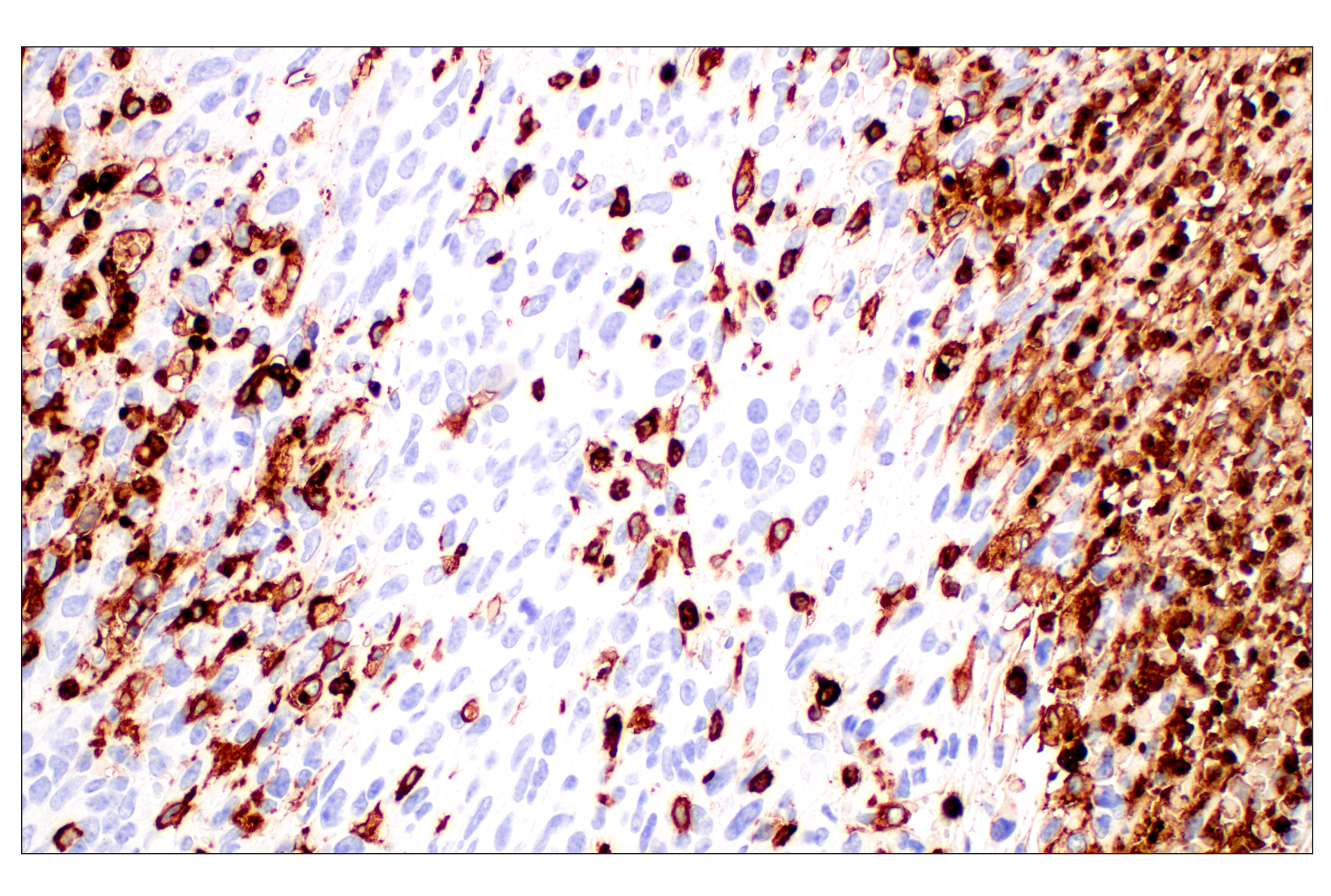 Immunohistochemistry Image 2: CD11b/ITGAM (E4K8C) Rabbit mAb (BSA and Azide Free)
