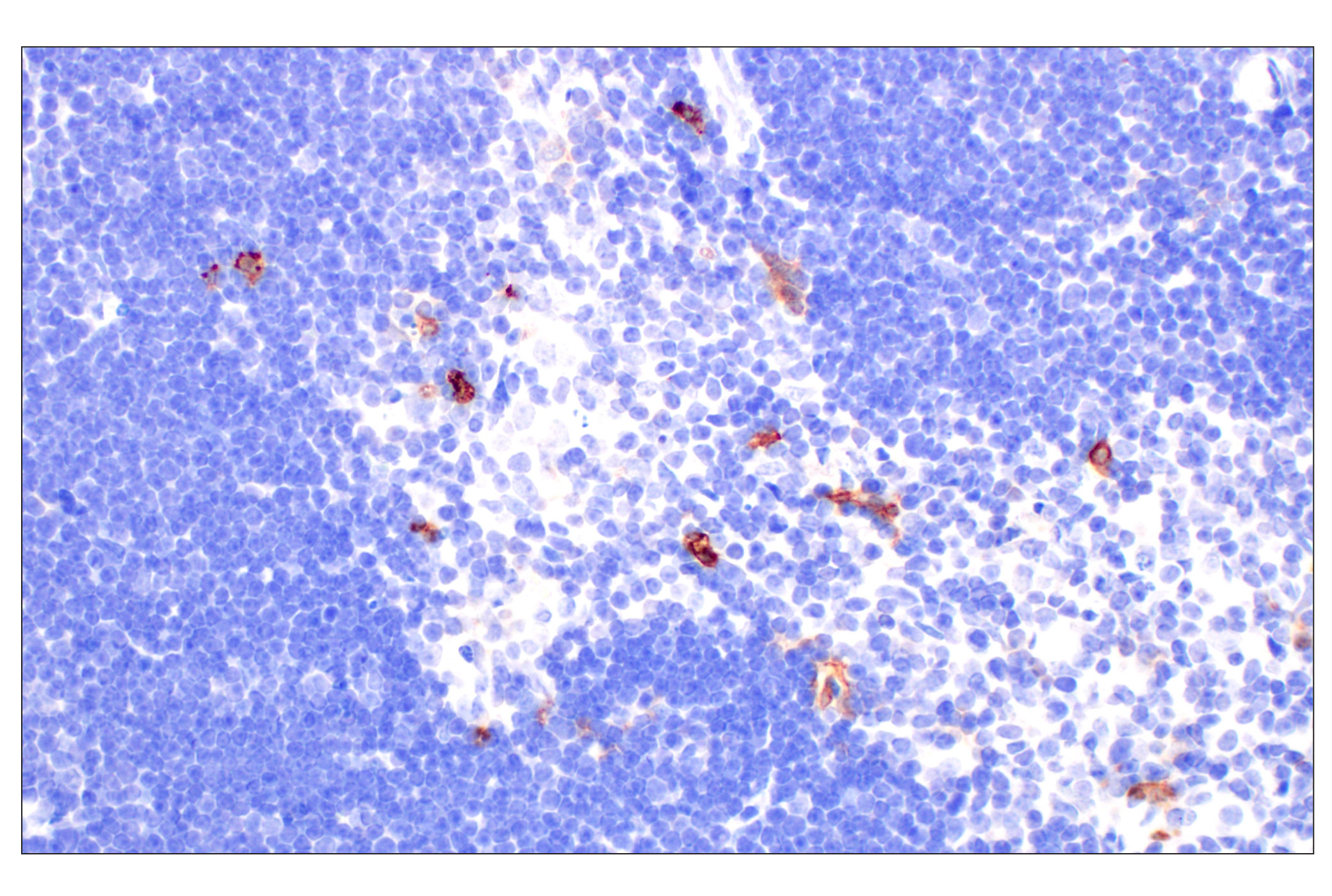 Immunohistochemistry Image 9: CD11b/ITGAM (E4K8C) Rabbit mAb (BSA and Azide Free)