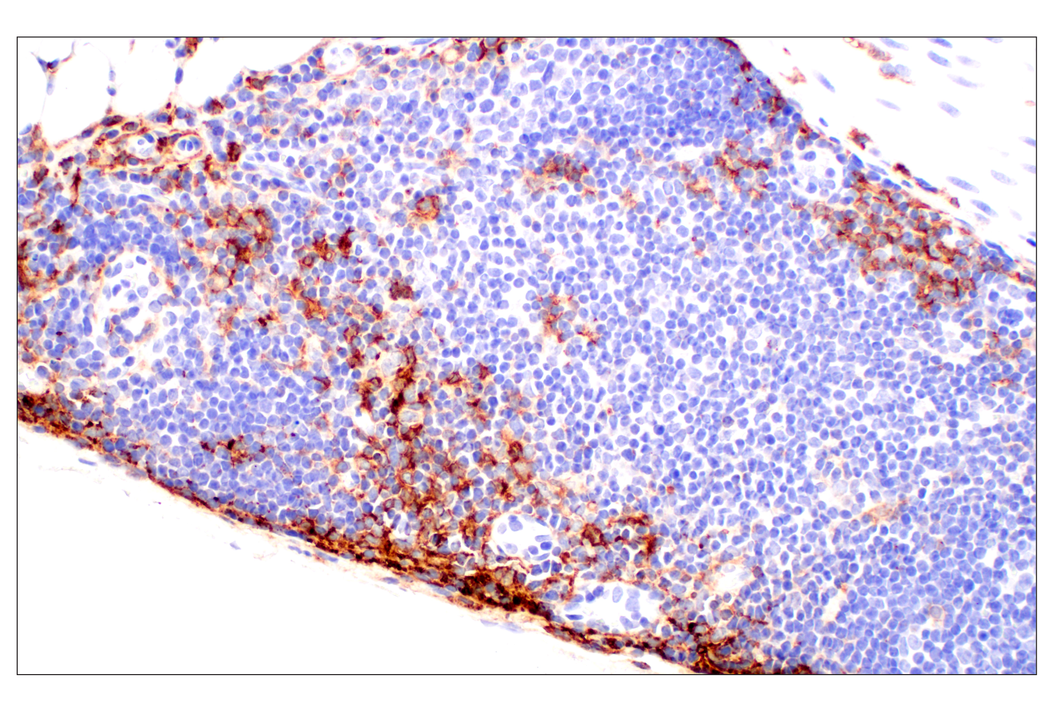 Immunohistochemistry Image 8: CD11b/ITGAM (E4K8C) Rabbit mAb (BSA and Azide Free)