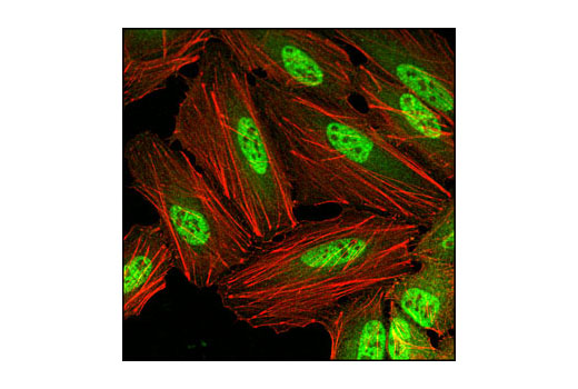 Immunofluorescence Image 1: PP2C-α (D18C10) XP® Rabbit mAb