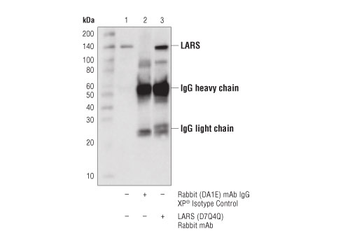 Immunoprecipitation Image 1: LARS (D7Q4Q) Rabbit mAb