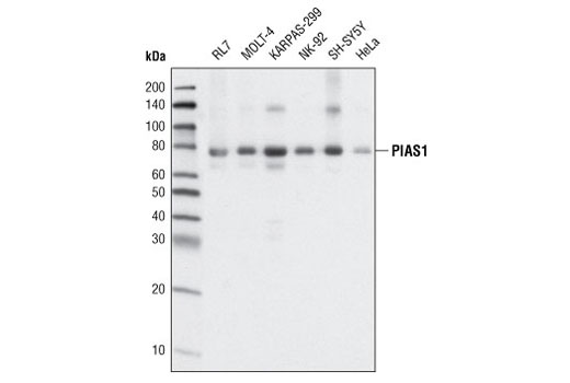  Image 2: Jak/Stat Pathway Inhibitors Antibody Sampler Kit