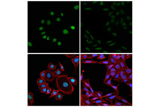 Immunofluorescence Image 1: PIAS1 (D33A7) XP® Rabbit mAb