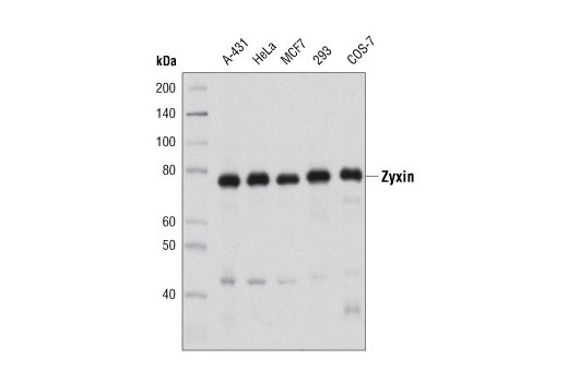 Western Blotting Image 1: Zyxin Antibody