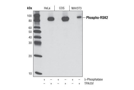 Western Blotting Image 1: Phospho-RSK2 (Ser227) (D53A11) Rabbit mAb