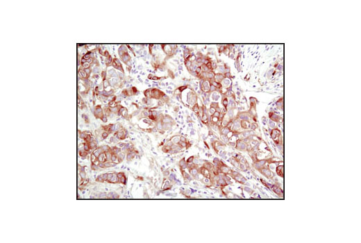 Immunohistochemistry Image 1: TGM2 (D11A6) XP® Rabbit mAb