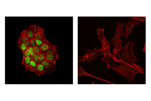 Immunofluorescence Image 1: Progesterone Receptor A/B (D8Q2J) XP® Rabbit mAb (Alexa Fluor® 488 Conjugate)