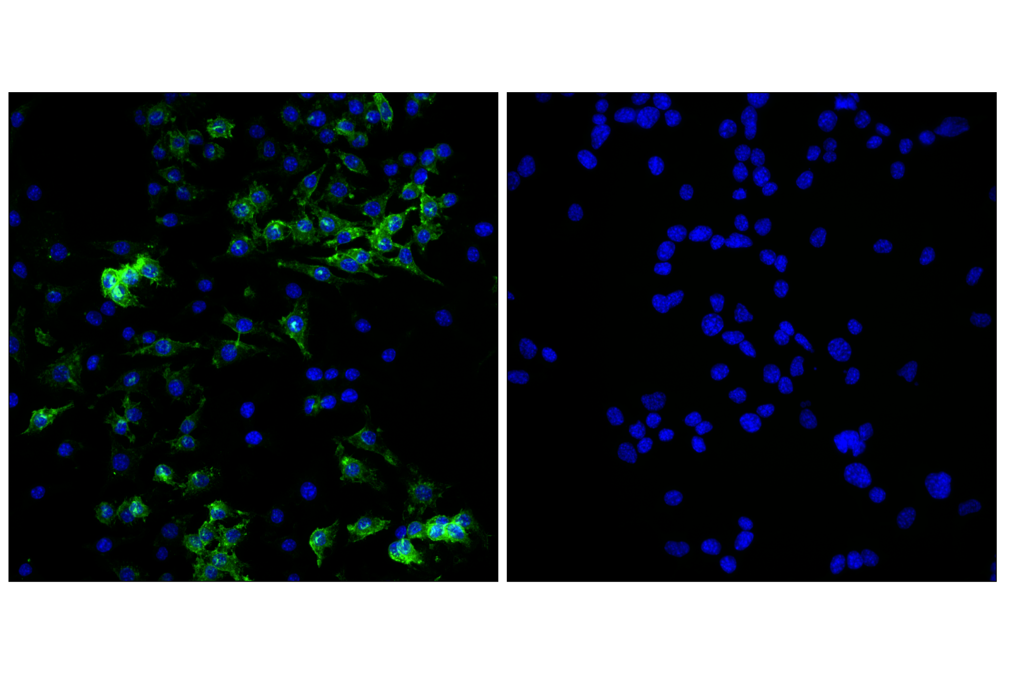 Immunofluorescence Image 2: PILRA (E6H7K) Rabbit mAb (BSA and Azide Free)
