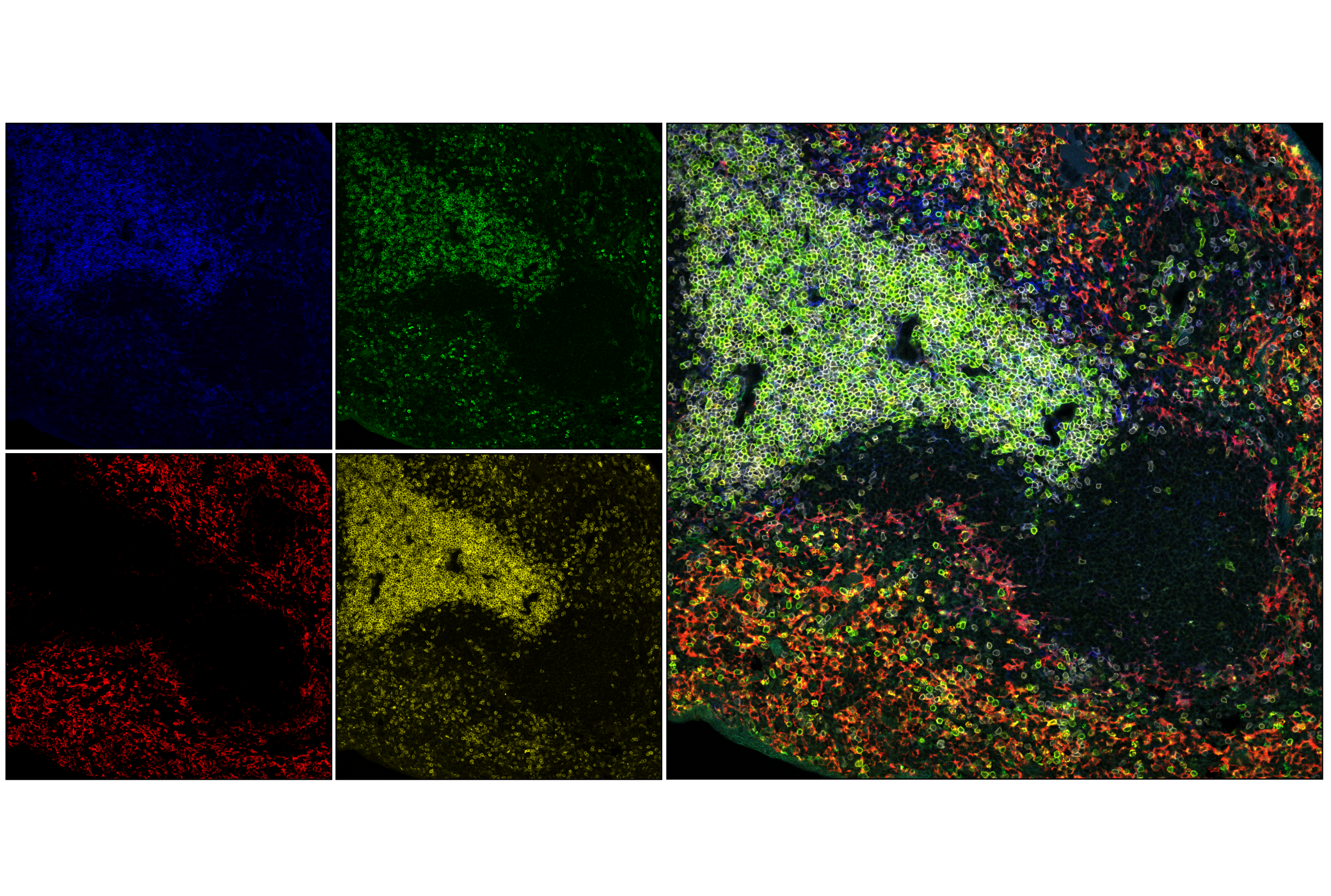 Immunofluorescence Image 1: PILRA (E6H7K) Rabbit mAb (BSA and Azide Free)
