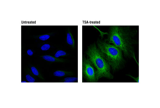 Immunofluorescence Image 1: Acetyl-α-Tubulin (Lys40) (D20G3) XP® Rabbit mAb (Alexa Fluor® 488 Conjugate)