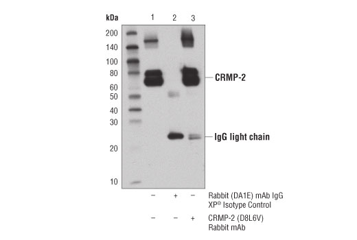 Immunoprecipitation Image 1: CRMP-2 (D8L6V) Rabbit mAb
