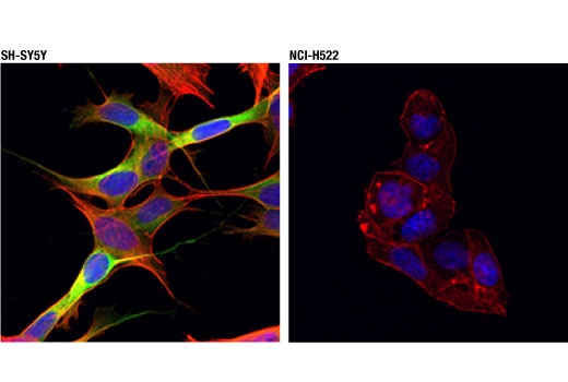 Immunofluorescence Image 1: CRMP-2 (D8L6V) Rabbit mAb