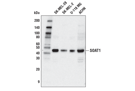 Western Blotting Image 1: SOAT1 Antibody