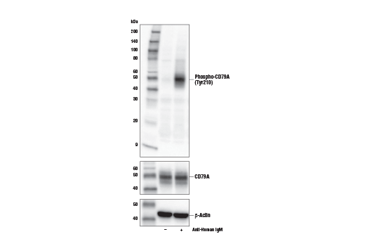 Western Blotting Image 1: Phospho-CD79A (Tyr210) Antibody