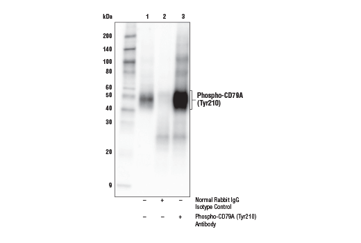 Immunoprecipitation Image 1: Phospho-CD79A (Tyr210) Antibody