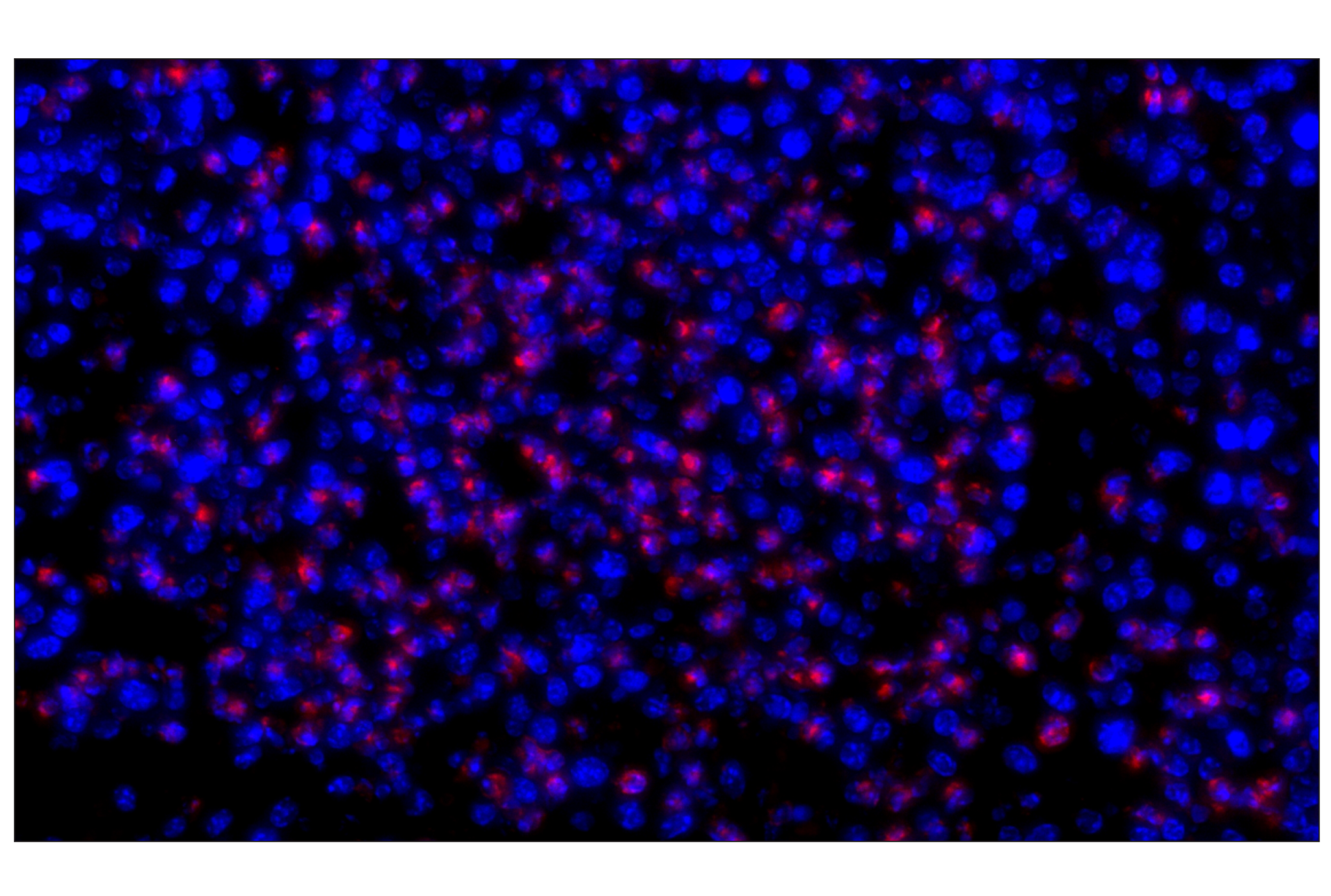 Immunohistochemistry Image 1: Ly-6G (E6Z1T) Rabbit mAb (Alexa Fluor® 647 Conjugate)