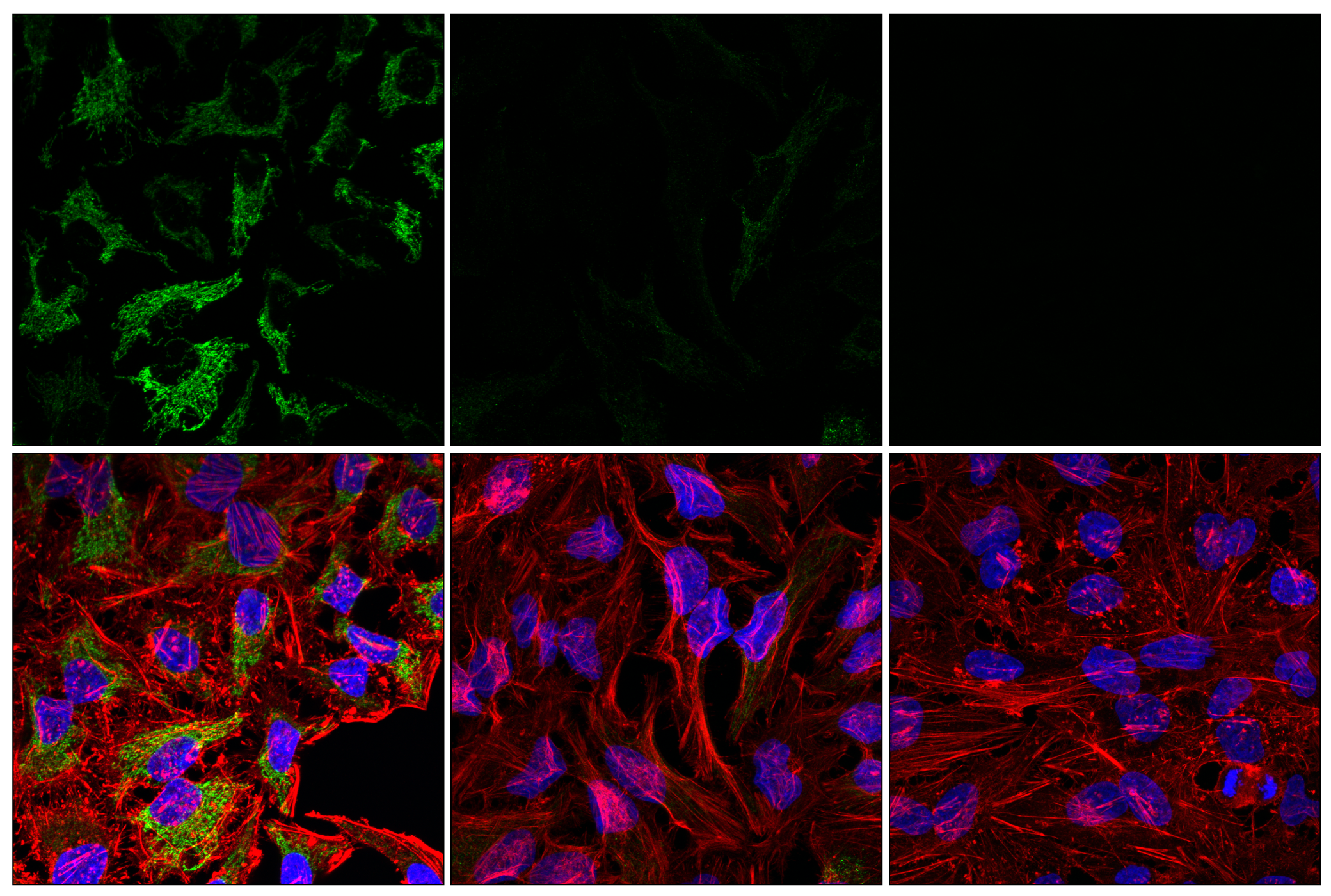Immunofluorescence Image 1: Phospho-Pyruvate Dehydrogenase α1 (Ser293) (E4V9L) Rabbit mAb (Alexa Fluor® 488 Conjugate)