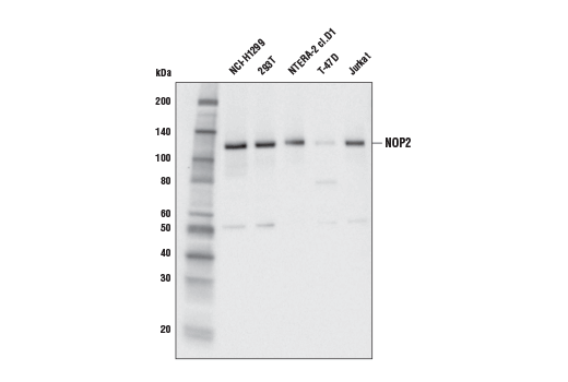 Western Blotting Image 1: NOP2 (L221) Antibody