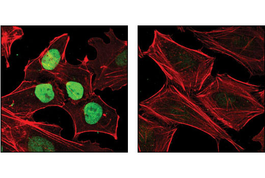 Immunofluorescence Image 1: Nanog Antibody