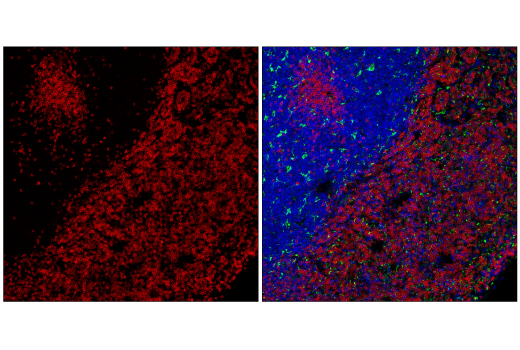 Immunofluorescence Image 1: CD20 (E3N7O) XP® Rabbit mAb (Alexa Fluor® 555 Conjugate)