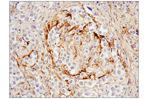 Immunohistochemistry Image 1: MMP-2 (D4M2N) Rabbit mAb (BSA and Azide Free)