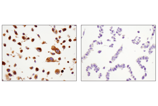 Immunohistochemistry Image 2: MMP-2 (D4M2N) Rabbit mAb (BSA and Azide Free)