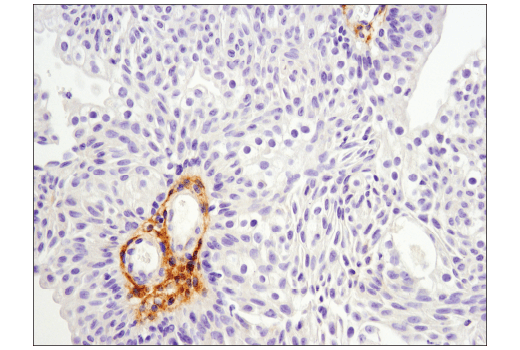 Immunohistochemistry Image 4: MMP-2 (D4M2N) Rabbit mAb (BSA and Azide Free)