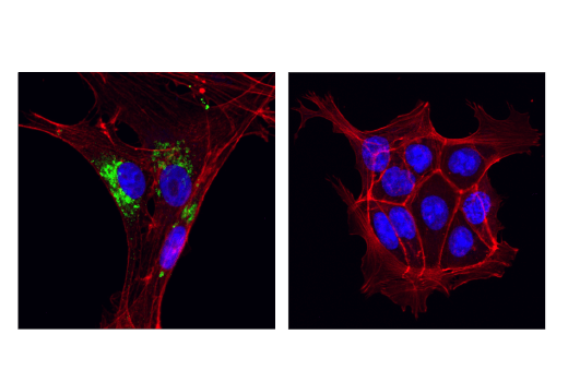 Immunofluorescence Image 1: MMP-2 (D4M2N) Rabbit mAb (BSA and Azide Free)