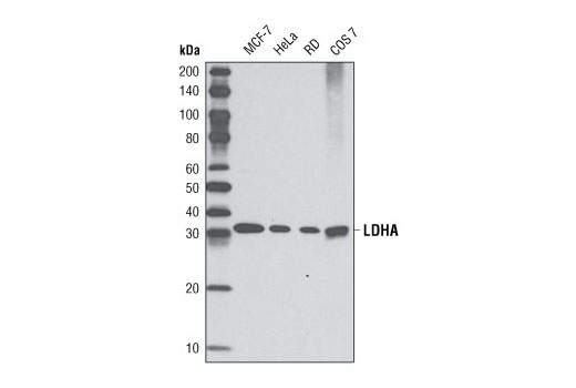  Image 5: Hypoxia Activation IHC Antibody Sampler Kit