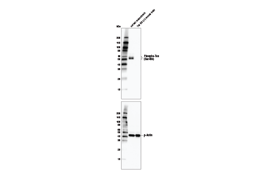  Image 3: Phospho-Tau Family Antibody Sampler Kit