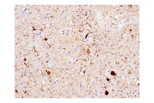 Immunohistochemistry Image 1: Phospho-Tau (Ser404) (D2Z4G) Rabbit mAb (IHC preferred)
