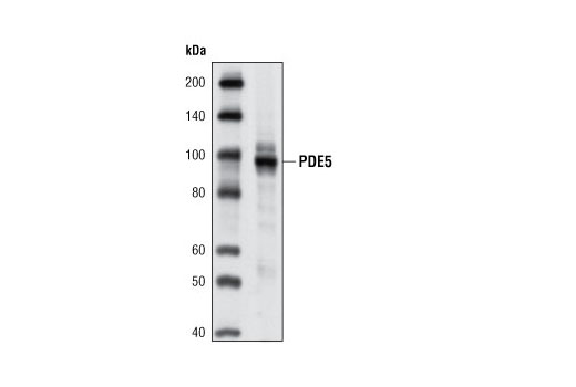 Western Blotting Image 1: PDE5 (P434) Antibody