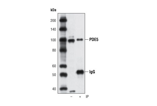 Immunoprecipitation Image 1: PDE5 (P434) Antibody