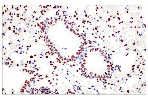 Immunohistochemistry Image 4: Tri-Methyl-Histone H3 (Lys27) (C36B11) Rabbit mAb (BSA and Azide Free)
